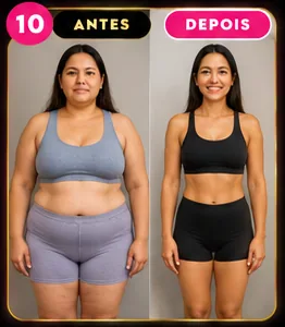 Comparação visual número 10